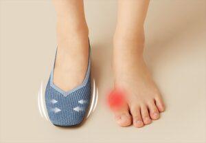 How To Stretch Shoes For Bunions