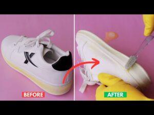 How To Remove Yellowing From White Sneaker Soles