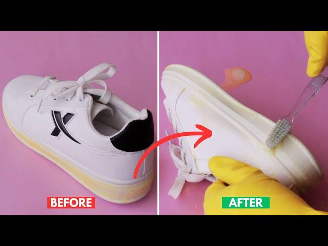 How To Remove Yellowing From White Sneaker Soles