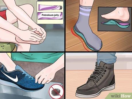 How To Prevent Blisters When Wearing New Sneakers