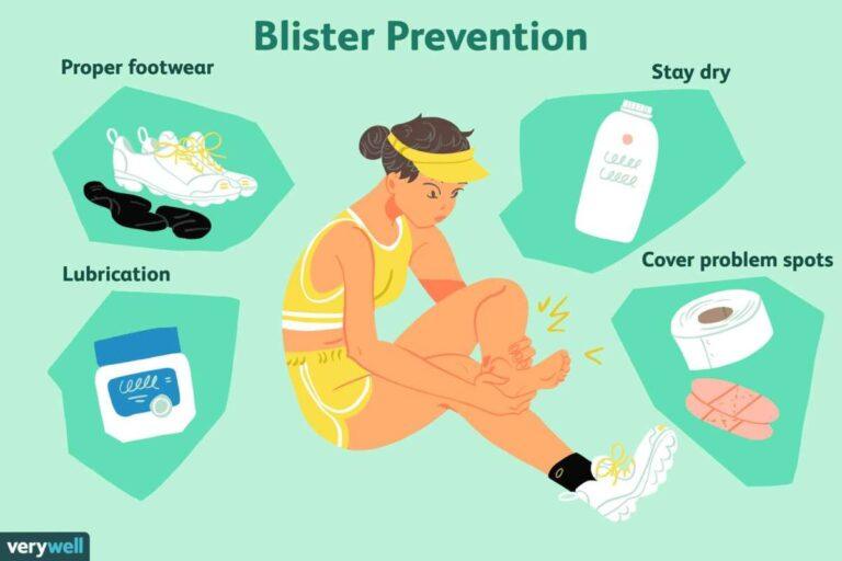 How Do You Prevent Blisters From New Shoes