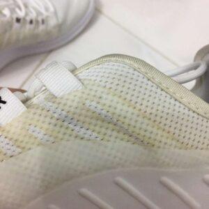 How To Get The Yellow Out Of White Shoes