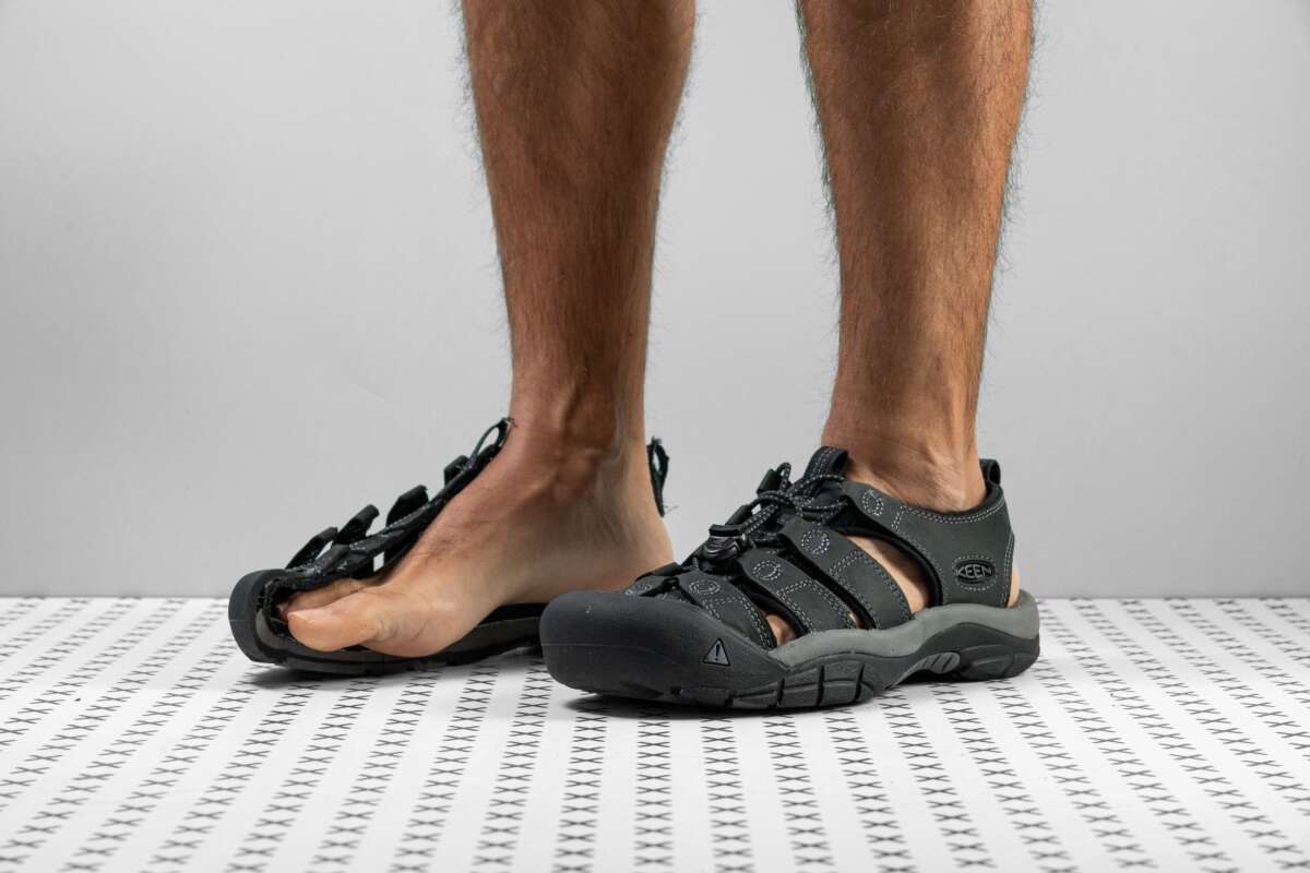 How To Back Down The Straps On My Keen Sandals