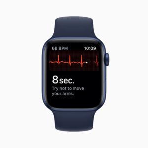 Does Apple Watch Have ECG