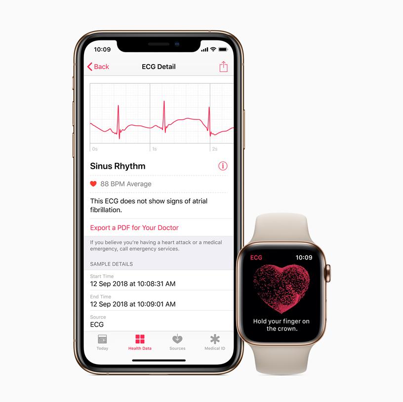 How To Run EKG On Apple Watch