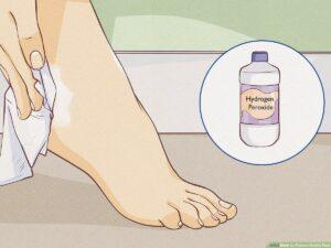 How To Get Rid Of Odor In Sandals