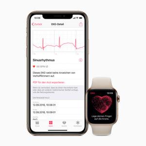 How To Take An ECG On Apple Watch