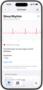 How To Get ECG On Apple Watch