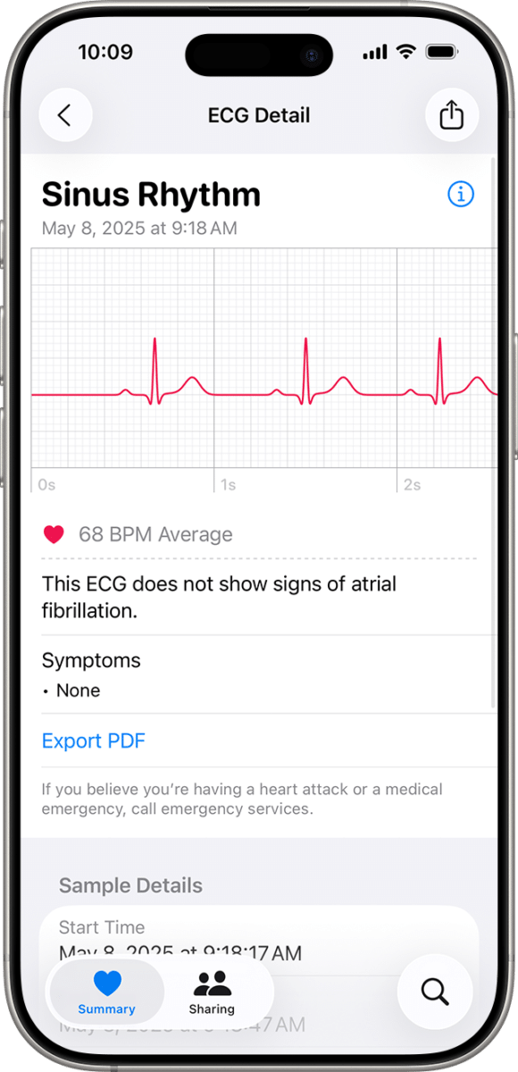 How To Get ECG On Apple Watch